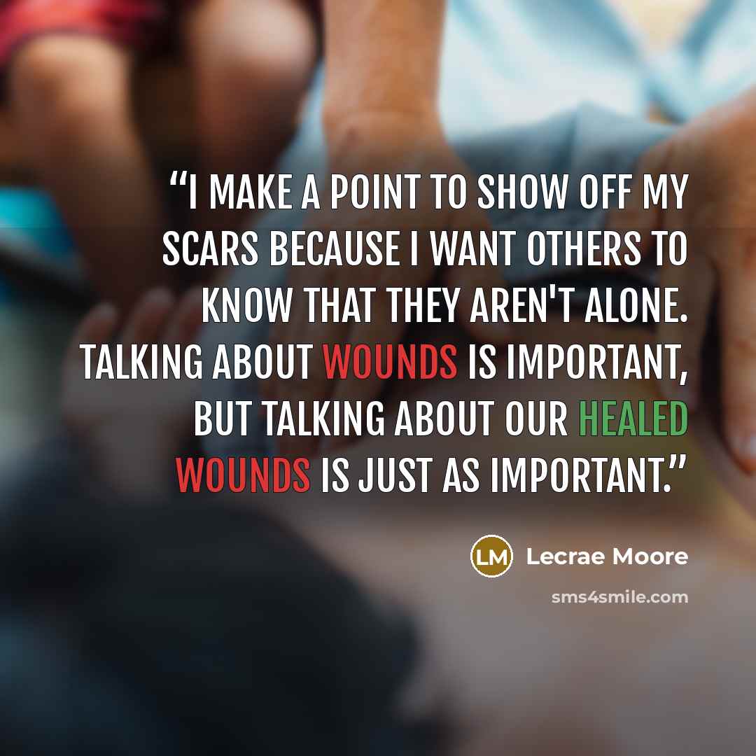 “I make a point to show off my scars because I want others to know that they aren't alone. Talking about wounds is important, but talking about our healed wounds is just as important.” quote by Lecrae Moore