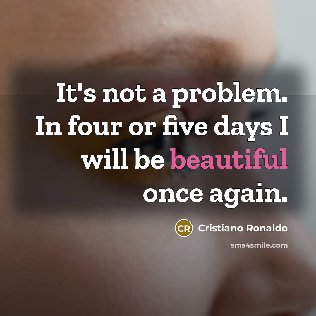 “It's not a problem. In four or five days I will be beautiful once again.” quote by Cristiano Ronaldo