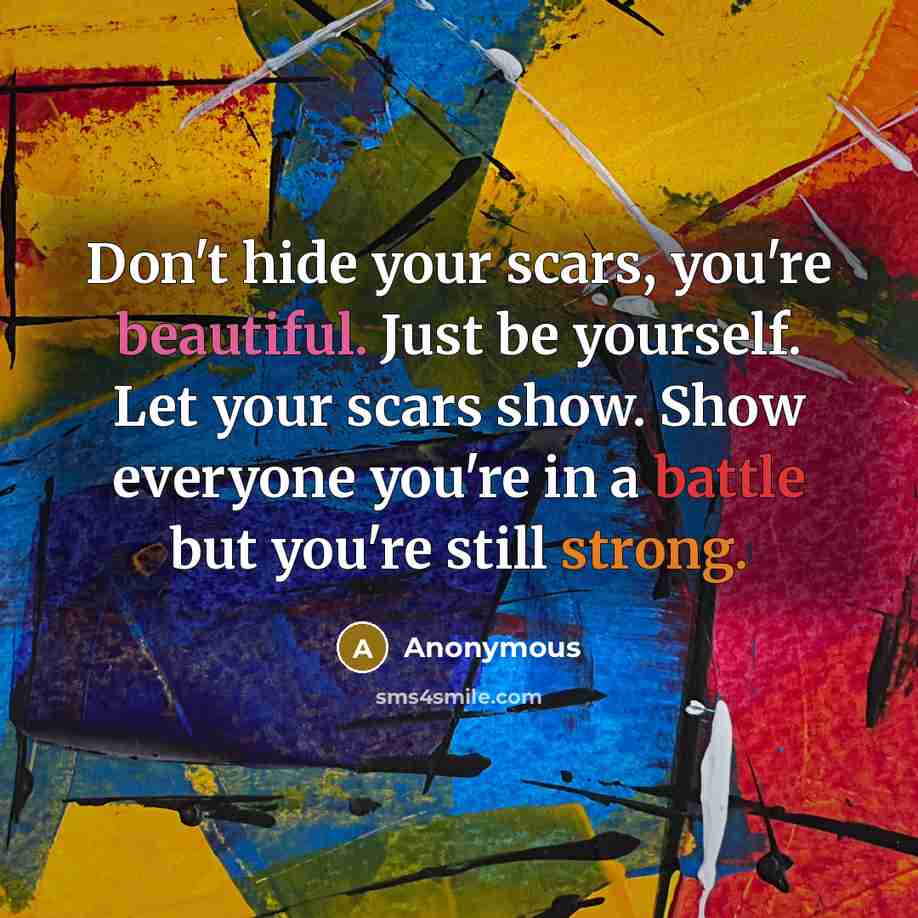 “Don't hide your scars, you're beautiful. Just be yourself. Let your scars show. Show everyone you're in a battle but you're still strong.” quote by Anonymous
