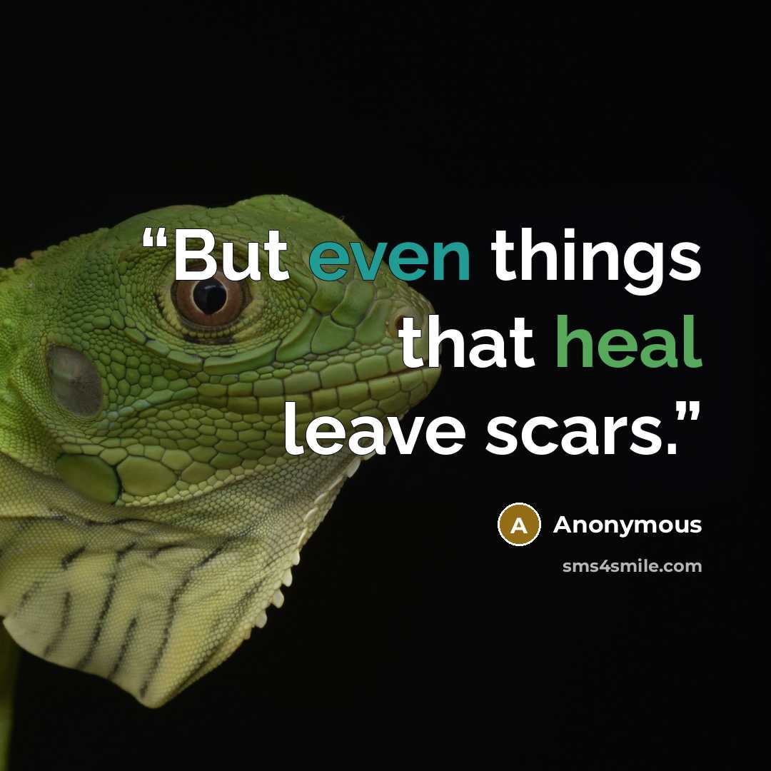 “But even things that heal leave scars.” quote by Anonymous