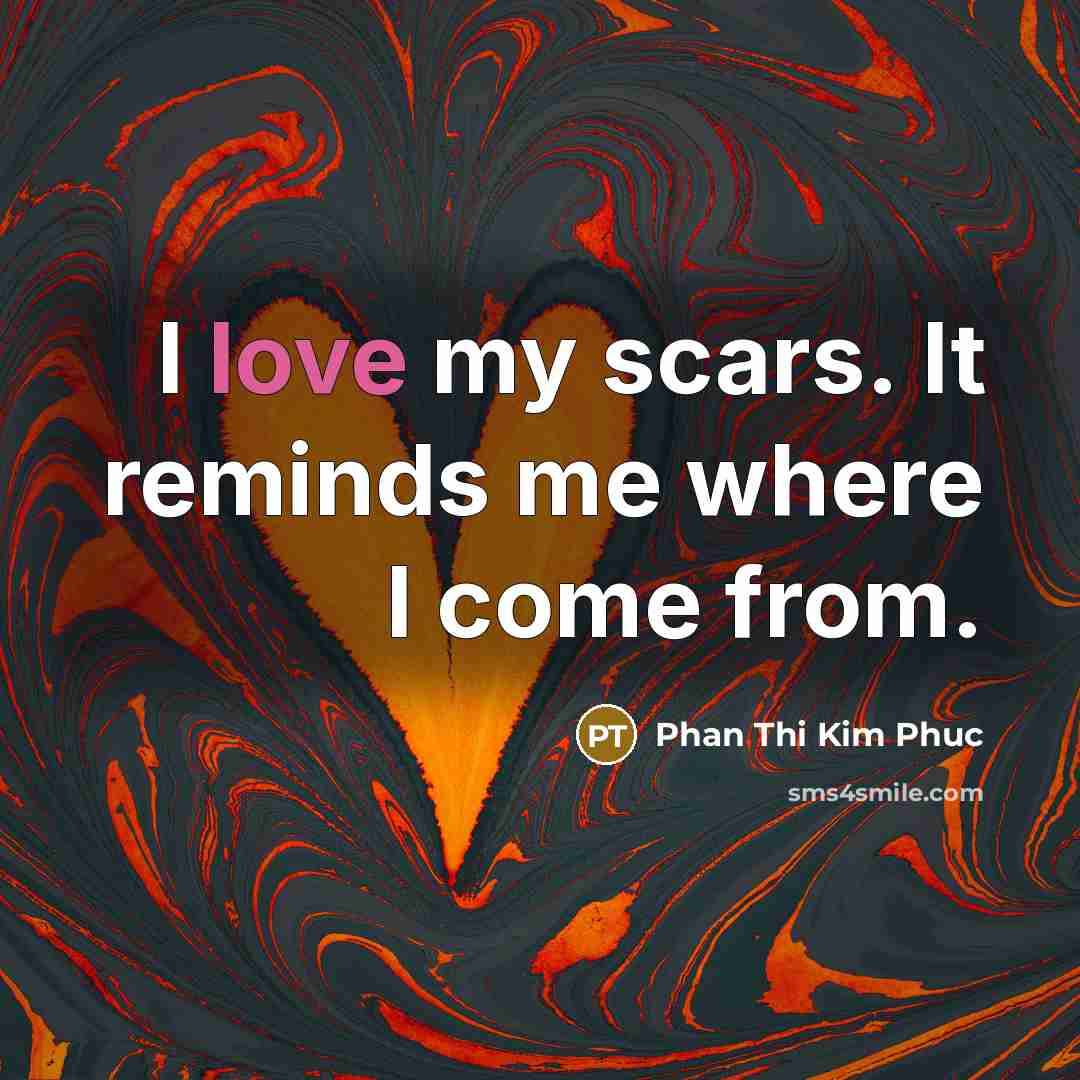 “I love my scars. It reminds me where I come from.” quote by Phan Thi Kim Phuc
