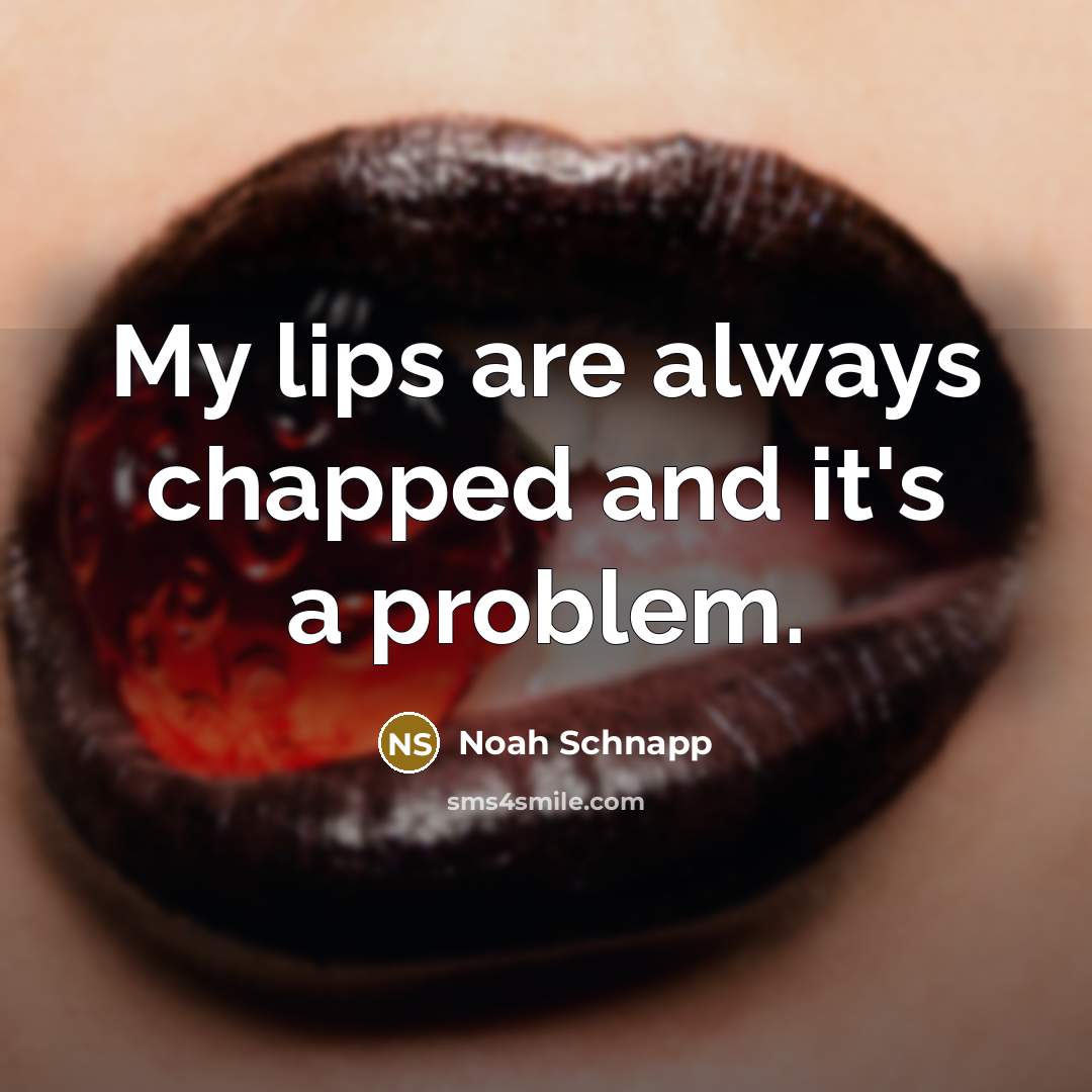 “My lips are always chapped and it's a problem.” quote by Noah Schnapp