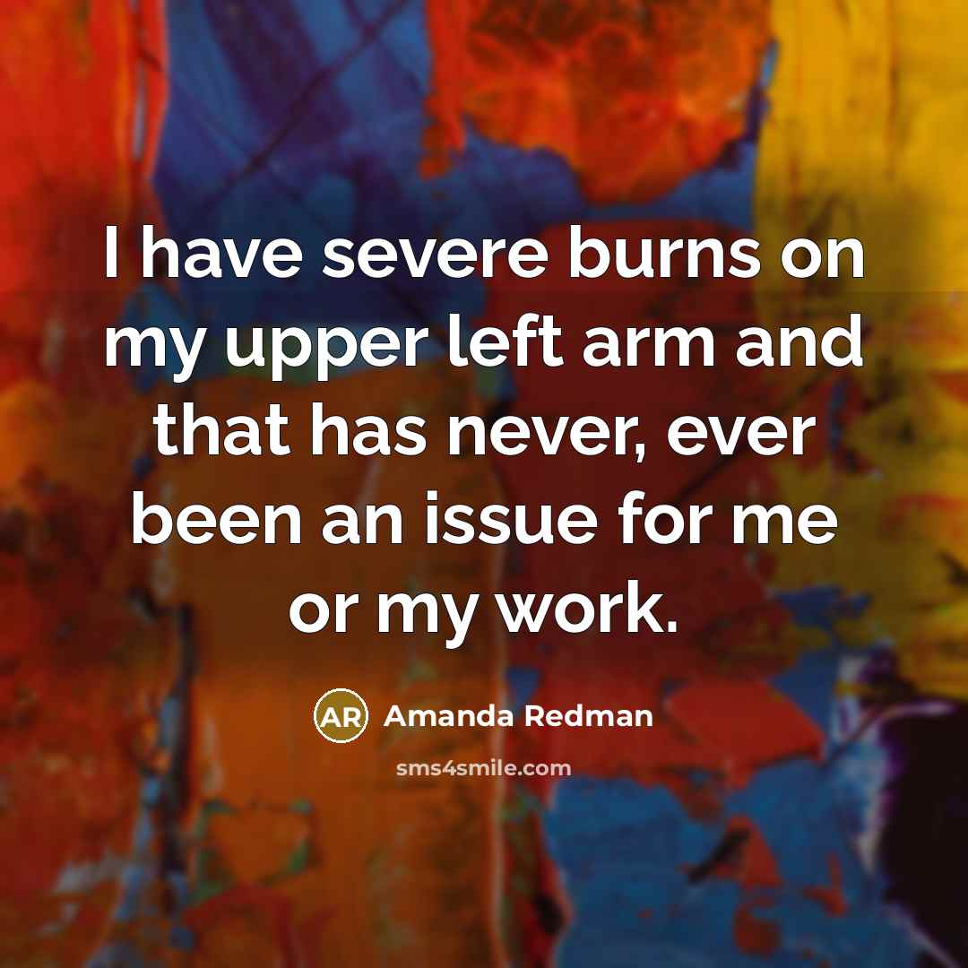 “I have severe burns on my upper left arm and that has never, ever been an issue for me or my work.” quote by Amanda Redman