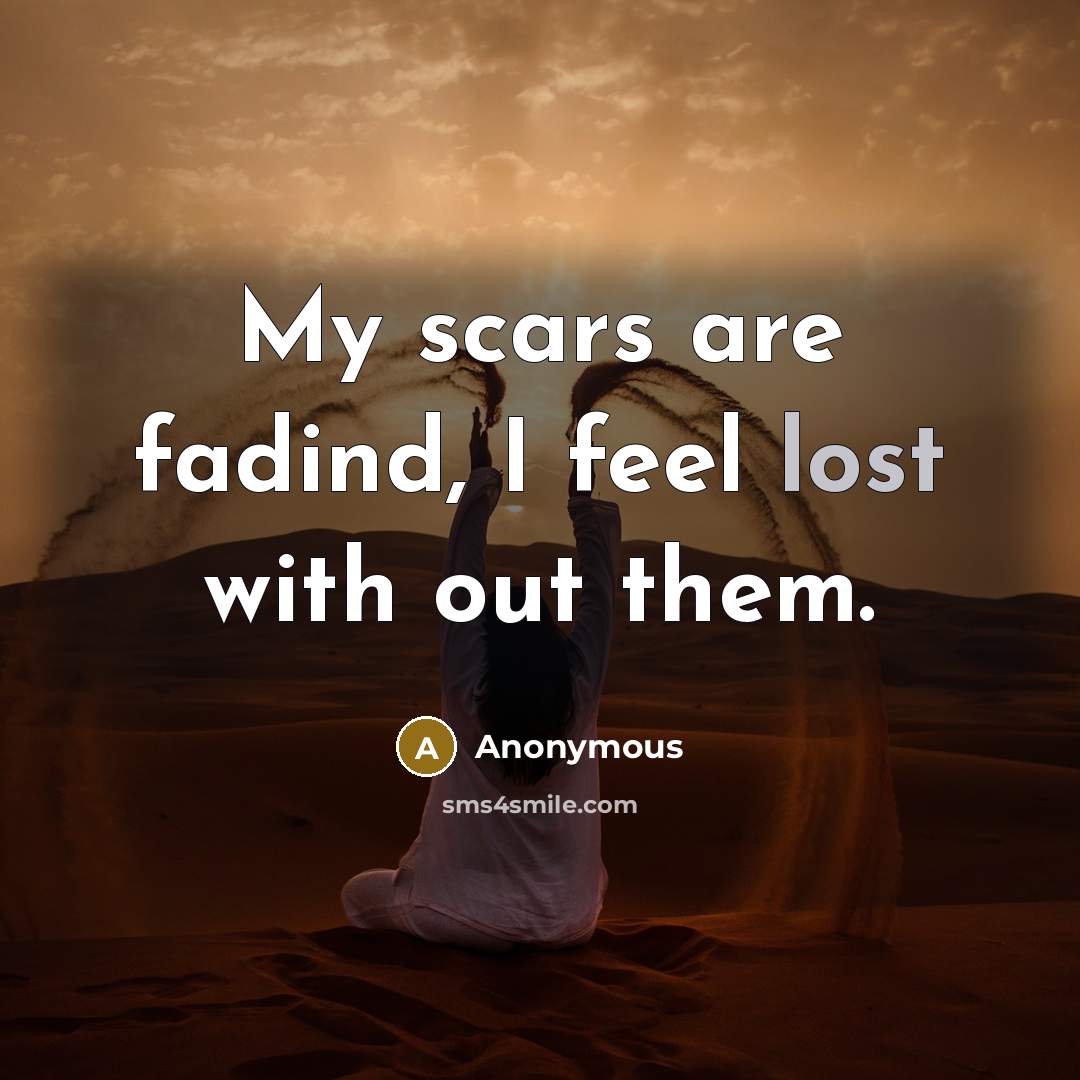 “My scars are fadind, I feel lost with out them.” quote by Anonymous