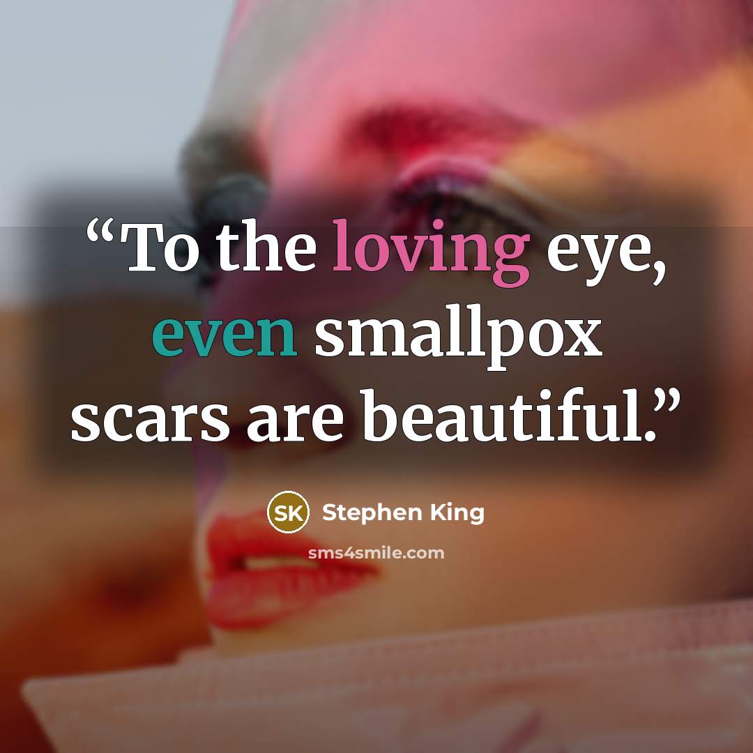 “To the loving eye, even smallpox scars are beautiful.” quote by Stephen King