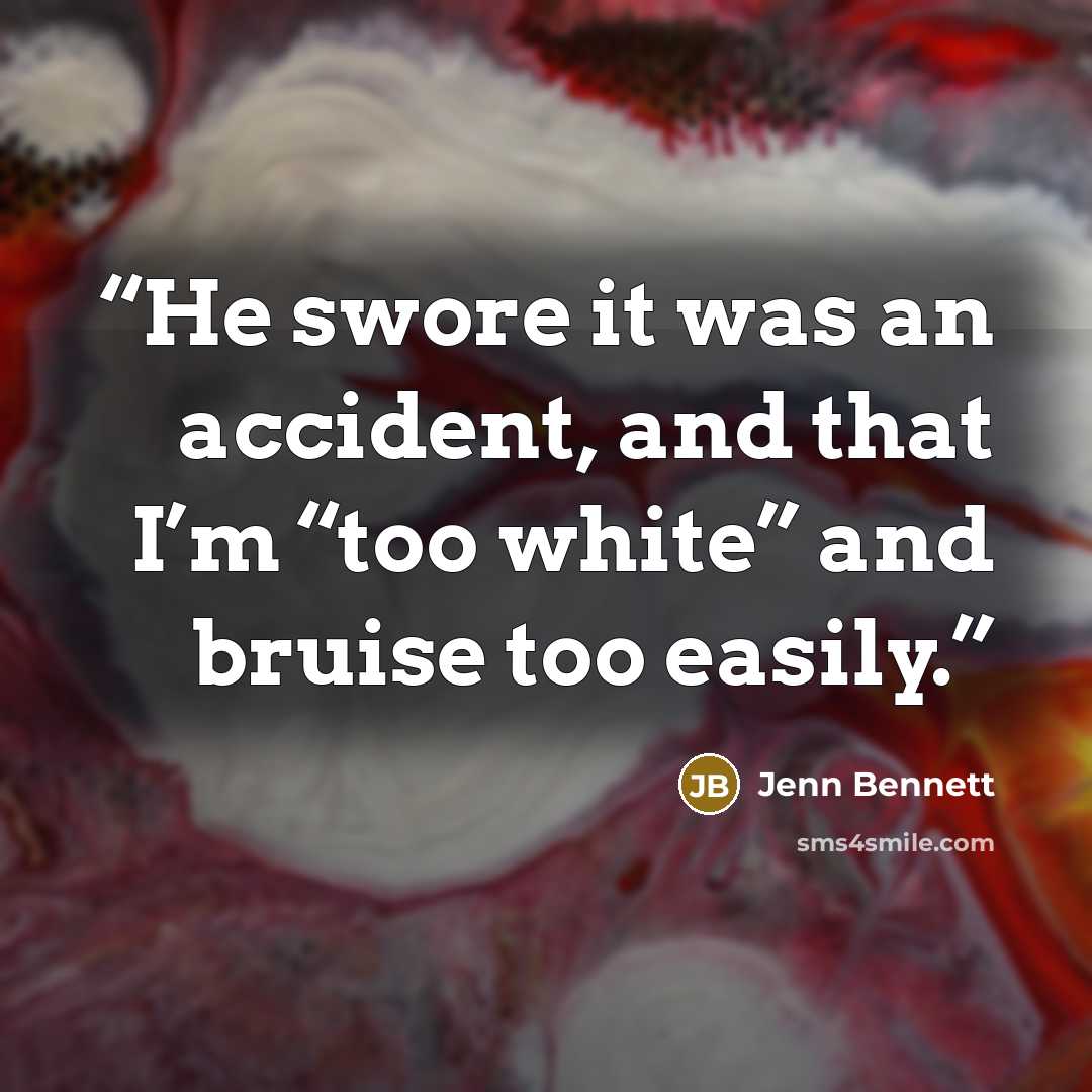 “He swore it was an accident, and that I’m “too white” and bruise too easily.” quote by Jenn Bennett