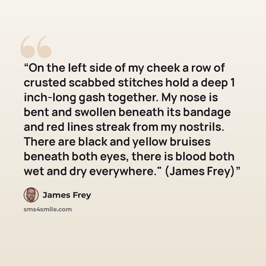 “On the left side of my cheek a row of crusted scabbed stitches hold a deep 1 inch-long gash together. My nose is bent and swollen beneath its bandage and red lines streak from my nostrils. There are black and yellow bruises beneath both eyes, there is blood both wet and dry everywhere." (James Frey)” quote by James Frey
