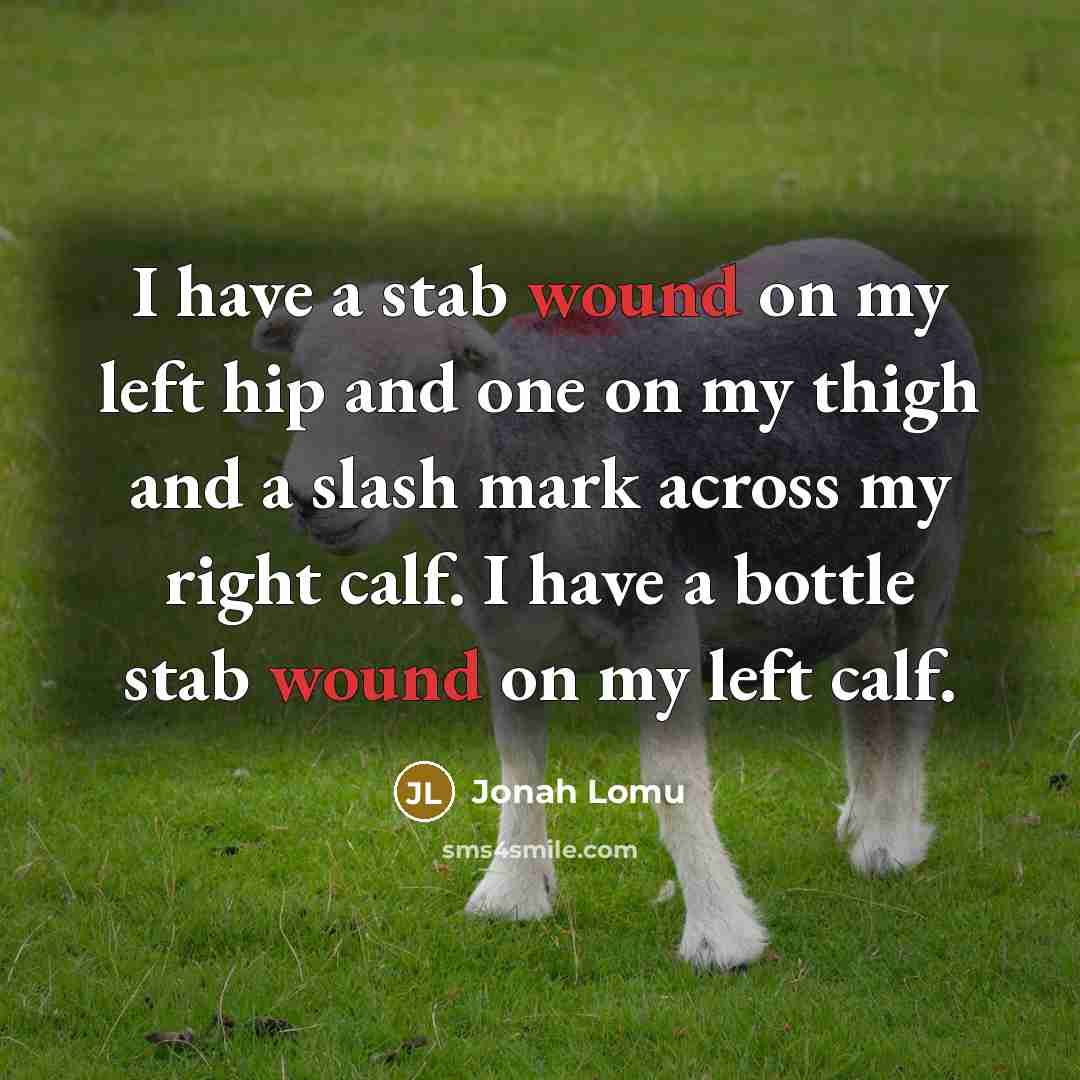 “I have a stab wound on my left hip and one on my thigh and a slash mark across my right calf. I have a bottle stab wound on my left calf.” quote by Jonah Lomu