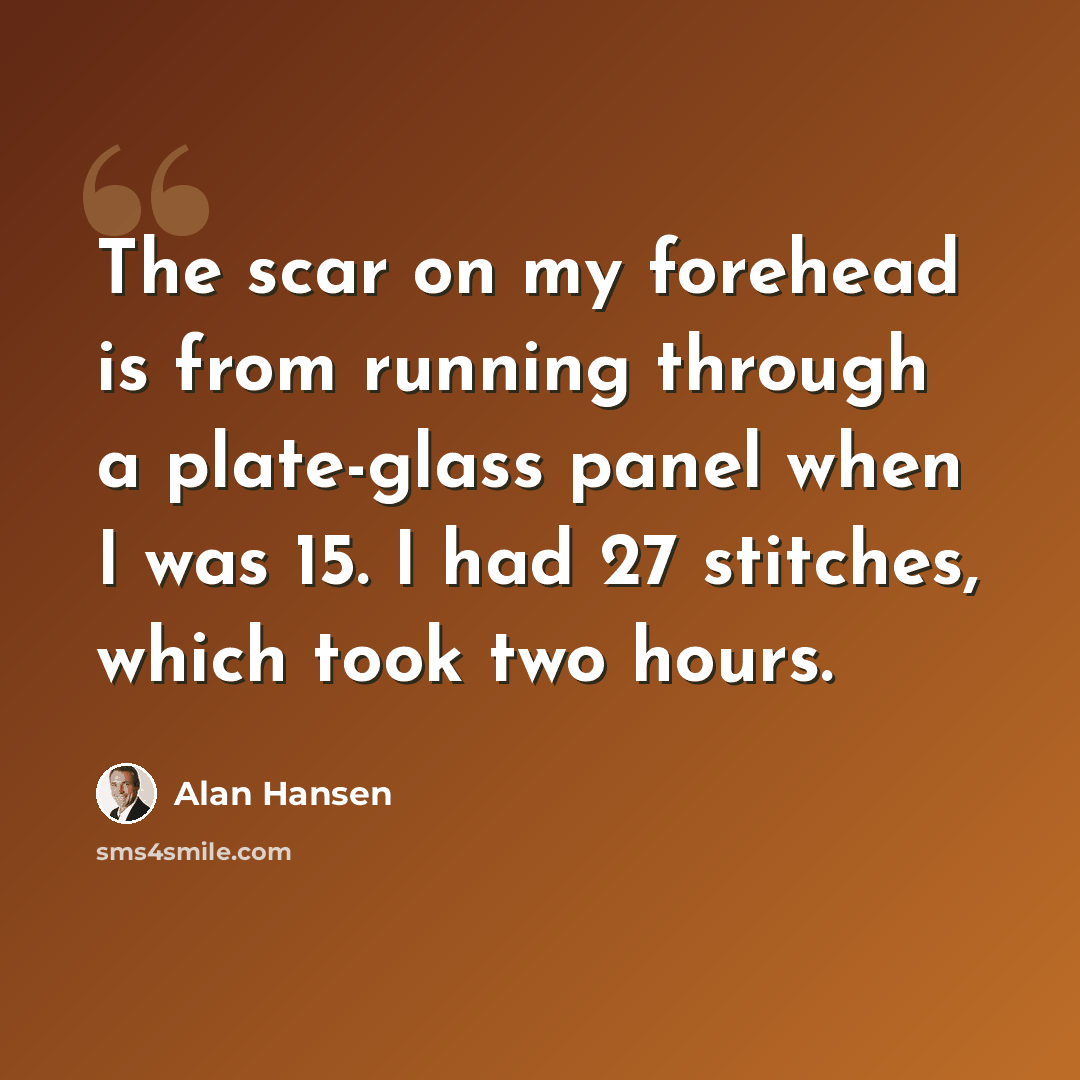 “The scar on my forehead is from running through a plate-glass panel when I was 15. I had 27 stitches, which took two hours.” quote by Alan Hansen