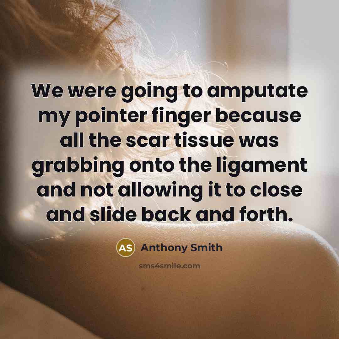 “We were going to amputate my pointer finger because all the scar tissue was grabbing onto the ligament and not allowing it to close and slide back and forth.” quote by Anthony Smith