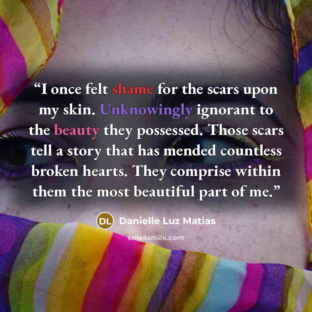 “I once felt shame for the scars upon my skin. Unknowingly ignorant to the beauty they possessed. Those scars tell a story that has mended countless broken hearts. They comprise within them the most beautiful part of me.” quote by Danielle Luz Matias