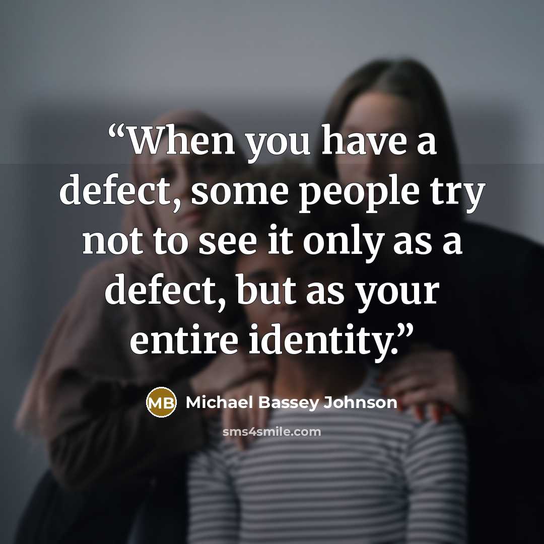 “When you have a defect, some people try not to see it only as a defect, but as your entire identity.” quote by Michael Bassey Johnson