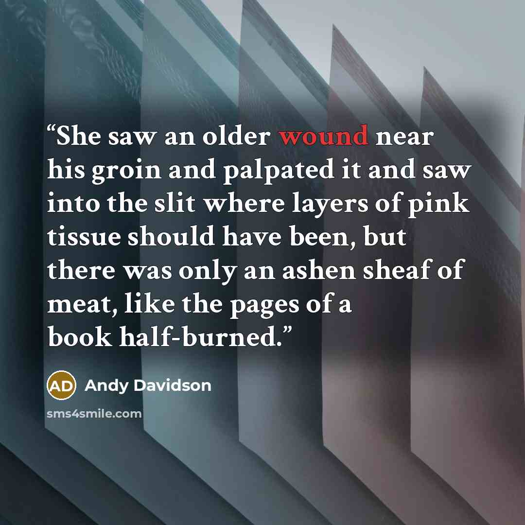 “She saw an older wound near his groin and palpated it and saw into the slit where layers of pink tissue should have been, but there was only an ashen sheaf of meat, like the pages of a book half-burned.” quote by Andy Davidson