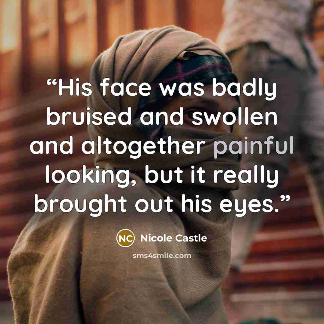 “His face was badly bruised and swollen and altogether painful looking, but it really brought out his eyes.” quote by Nicole Castle