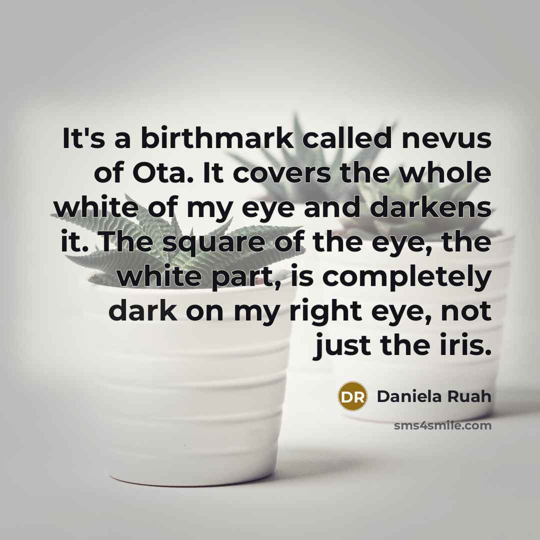“It's a birthmark called nevus of Ota. It covers the whole white of my eye and darkens it. The square of the eye, the white part, is completely dark on my right eye, not just the iris.” quote by Daniela Ruah
