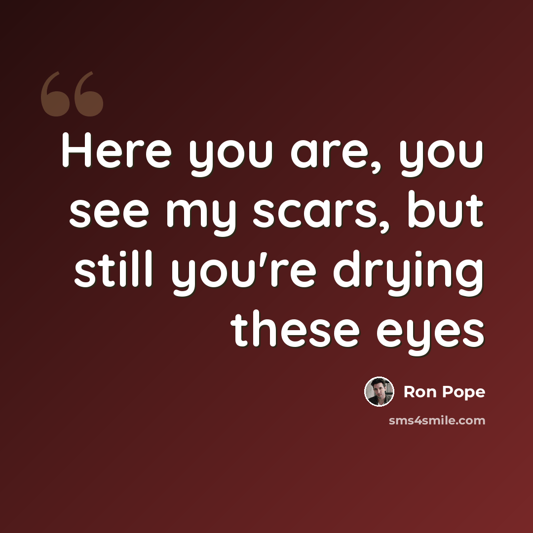 “Here you are, you see my scars, but still you're drying these eyes” quote by Ron Pope