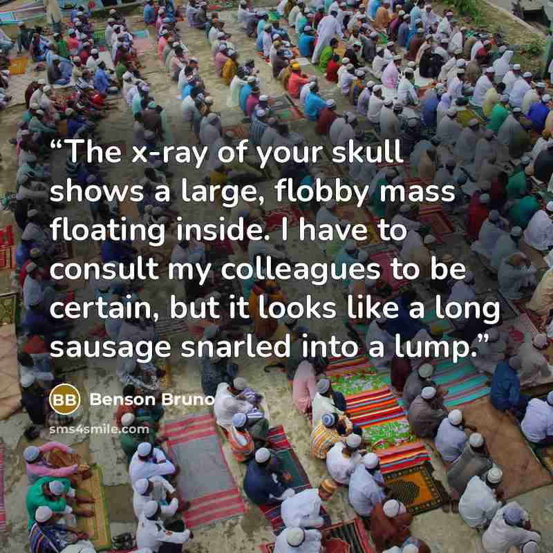 “The x-ray of your skull shows a large, flobby mass floating inside. I have to consult my colleagues to be certain, but it looks like a long sausage snarled into a lump.” quote by Benson Bruno