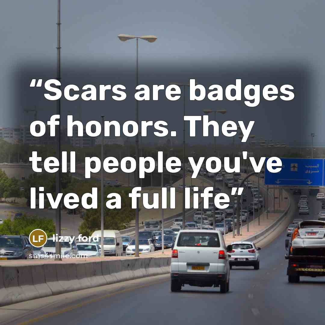 “Scars are badges of honors. They tell people you've lived a full life” quote by Lizzy Ford