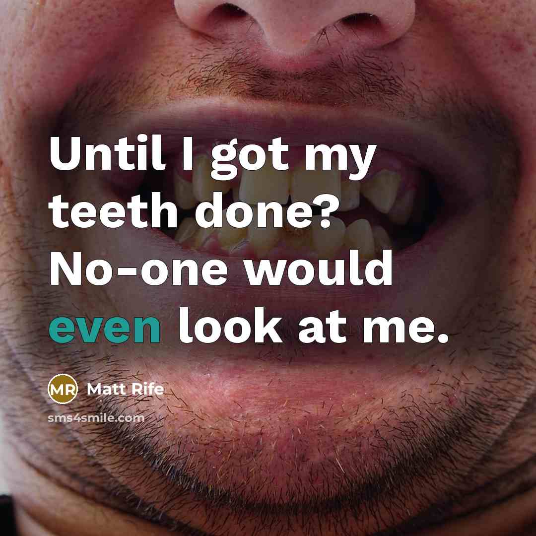“Until I got my teeth done? No-one would even look at me.” quote by Matt Rife