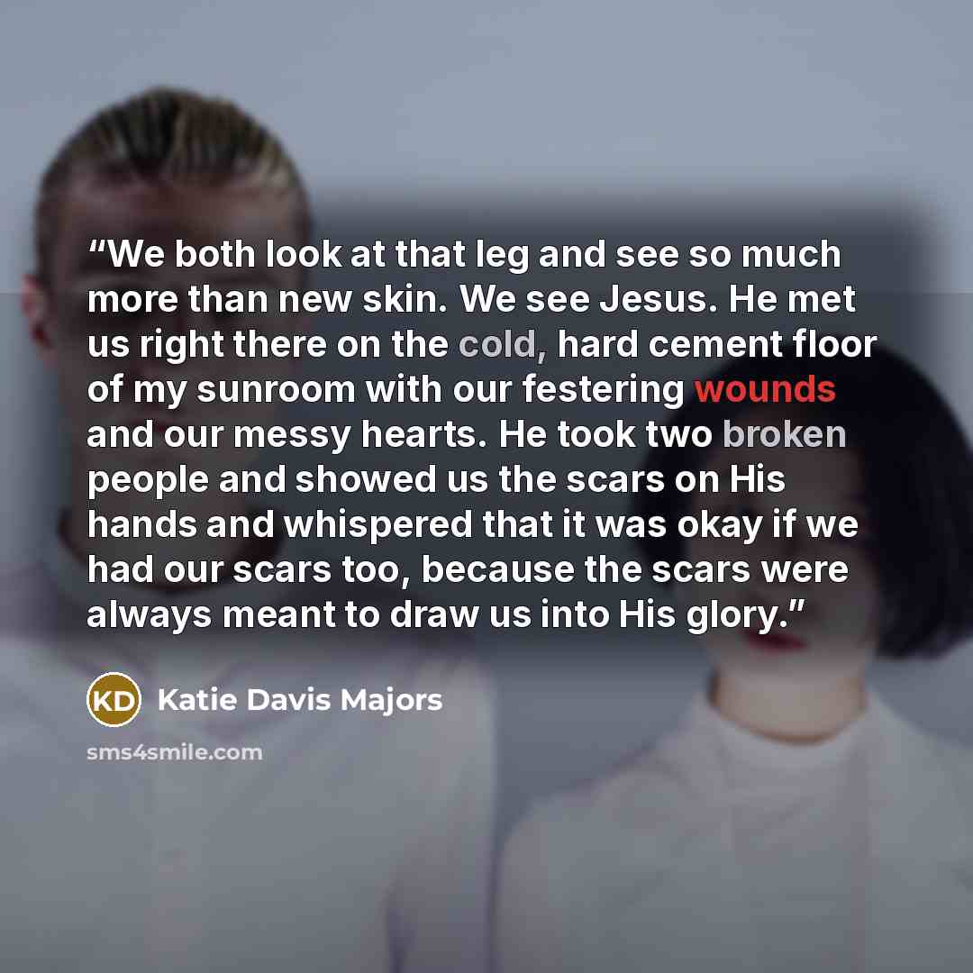 “We both look at that leg and see so much more than new skin. We see Jesus. He met us right there on the cold, hard cement floor of my sunroom with our festering wounds and our messy hearts. He took two broken people and showed us the scars on His hands and whispered that it was okay if we had our…” quote by Katie Davis Majors