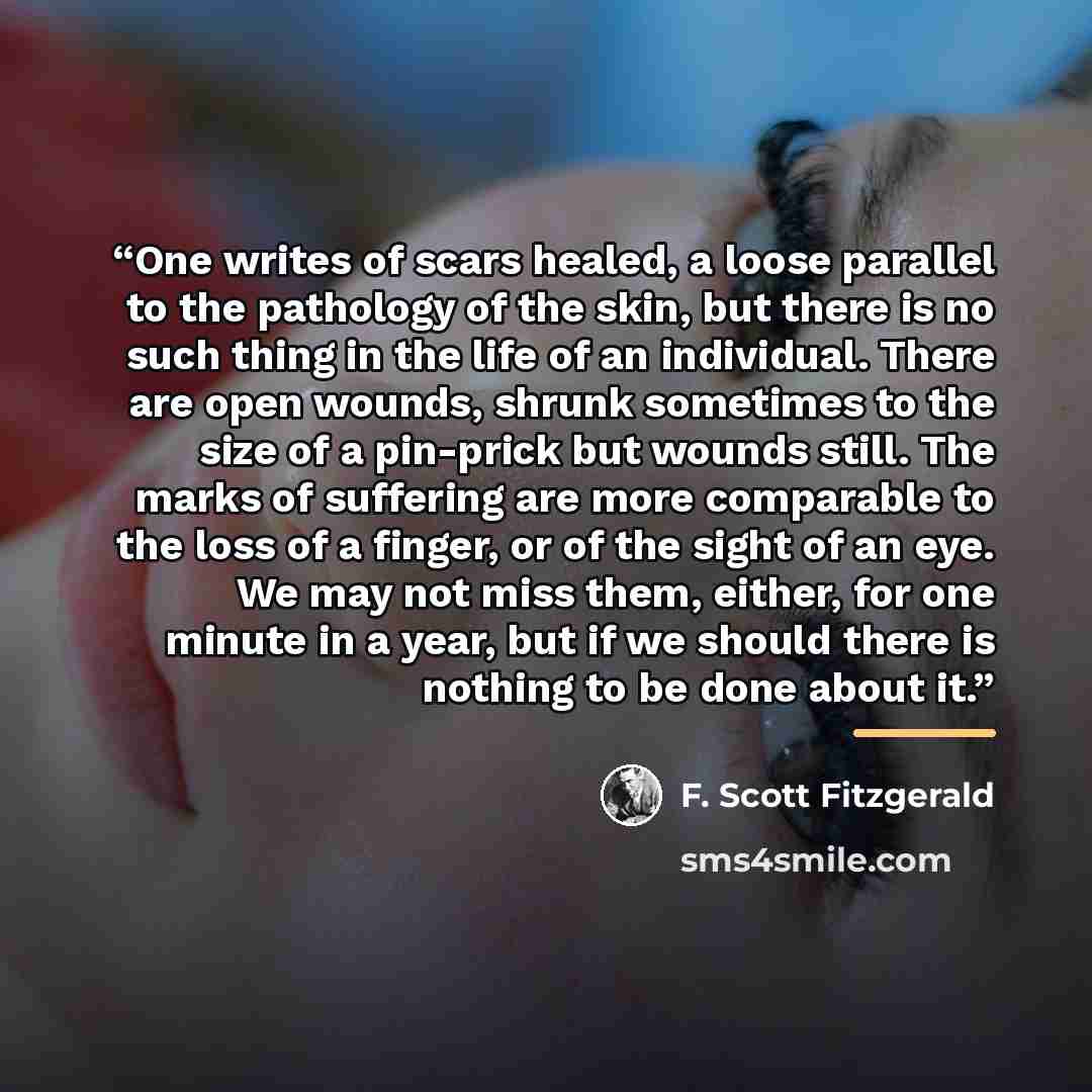 “One writes of scars healed, a loose parallel to the pathology of the skin, but there is no such thing in the life of an individual. There are open wounds, shrunk sometimes to the size of a pin-prick but wounds still. The marks of suffering are more comparable to the loss of a finger, or of the…” quote by F. Scott Fitzgerald