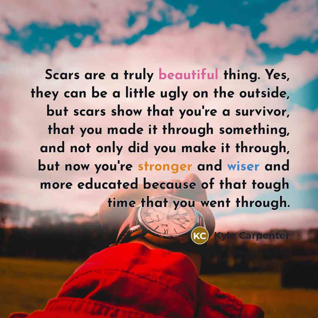 “Scars are a truly beautiful thing. Yes, they can be a little ugly on the outside, but scars show that you're a survivor, that you made it through something, and not only did you make it through, but now you're stronger and wiser and more educated because of that tough time that you went through.” quote by Kyle Carpenter
