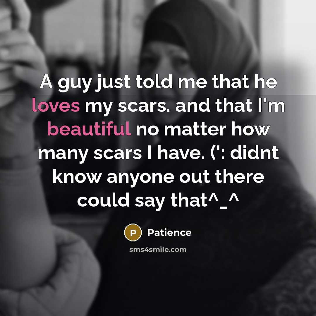 “A guy just told me that he loves my scars. and that I'm beautiful no matter how many scars I have. (': didnt know anyone out there could say that^_^” quote by Patience