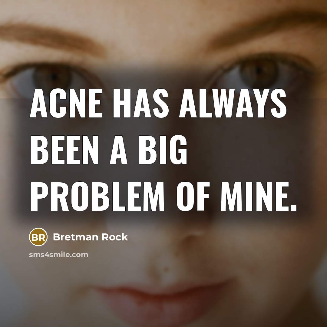 “Acne has always been a big problem of mine.” quote by Bretman Rock