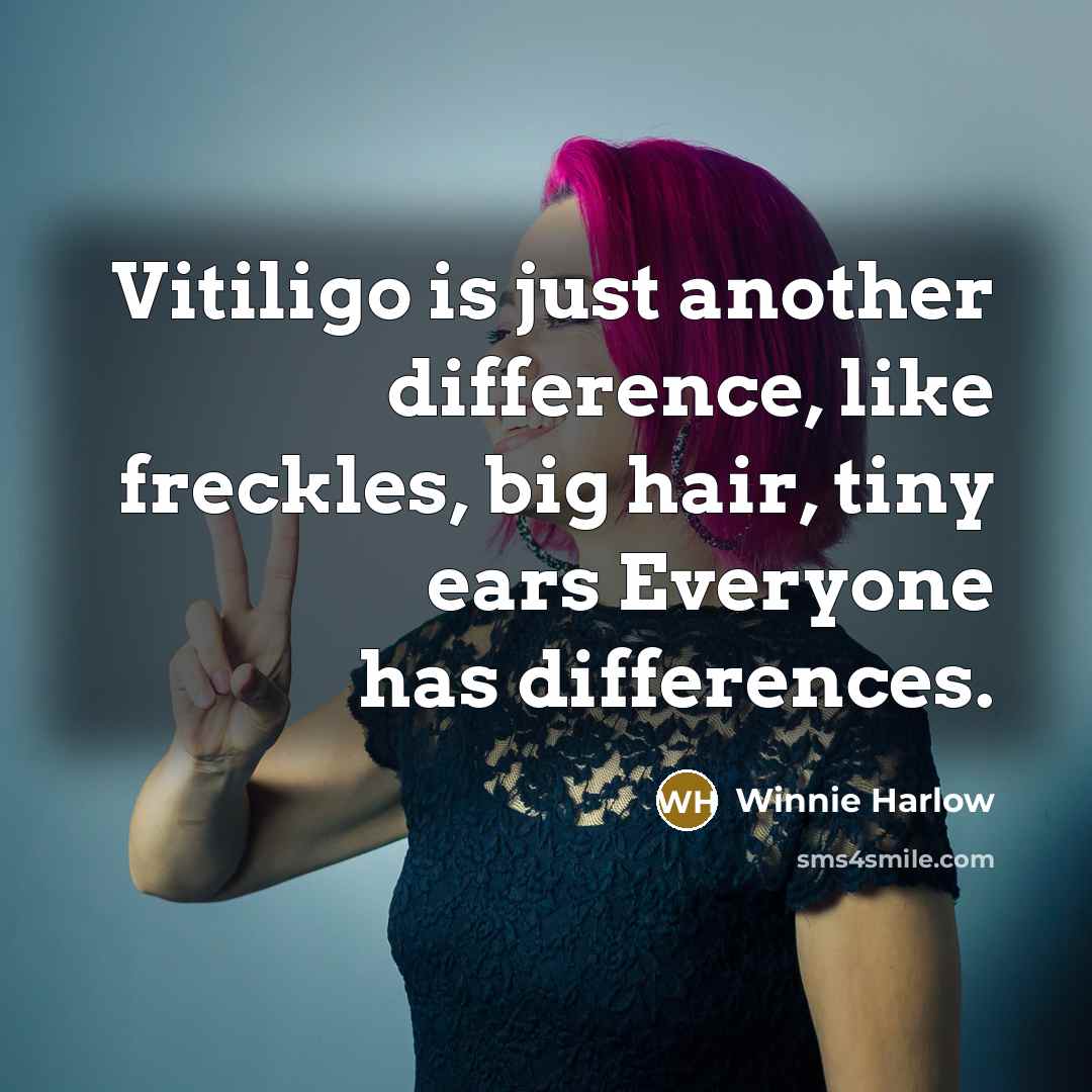 “Vitiligo is just another difference, like freckles, big hair, tiny ears Everyone has differences.” quote by Winnie Harlow