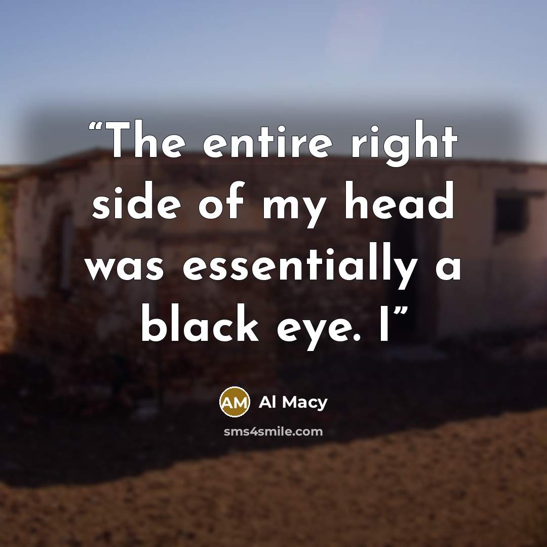 “The entire right side of my head was essentially a black eye. I” quote by Al Macy
