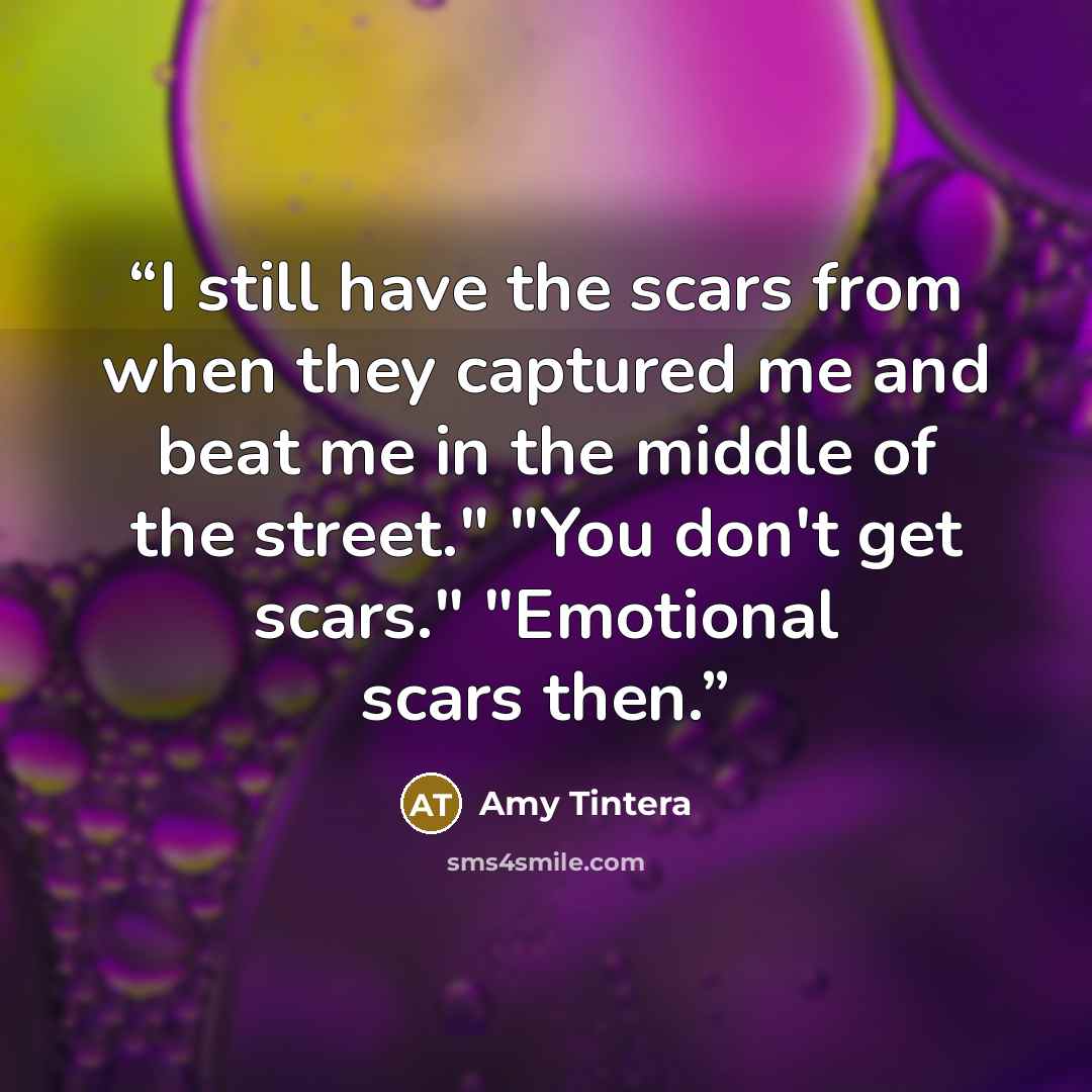 “I still have the scars from when they captured me and beat me in the middle of the street." "You don't get scars." "Emotional scars then.” quote by Amy Tintera