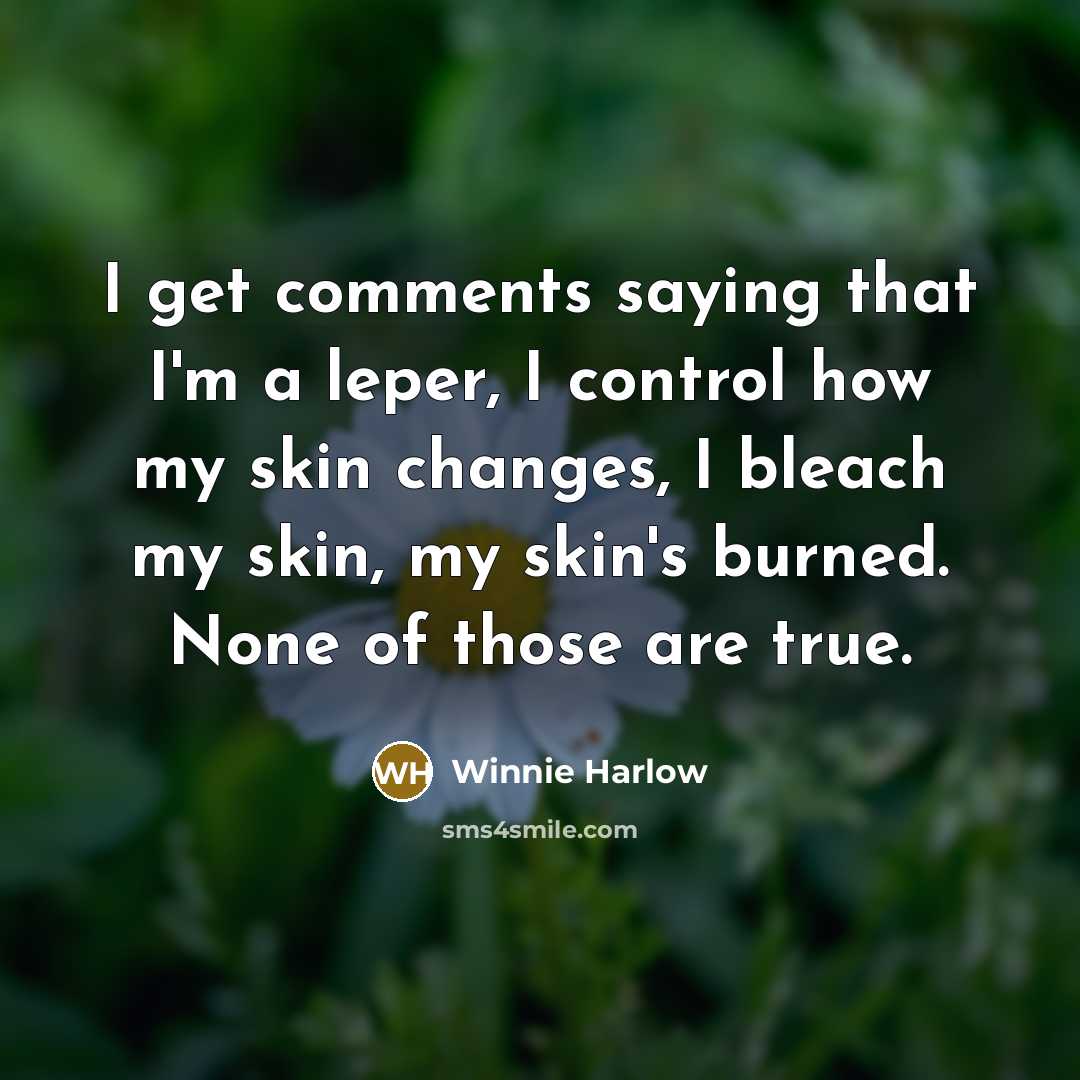 “I get comments saying that I'm a leper, I control how my skin changes, I bleach my skin, my skin's burned. None of those are true.” quote by Winnie Harlow