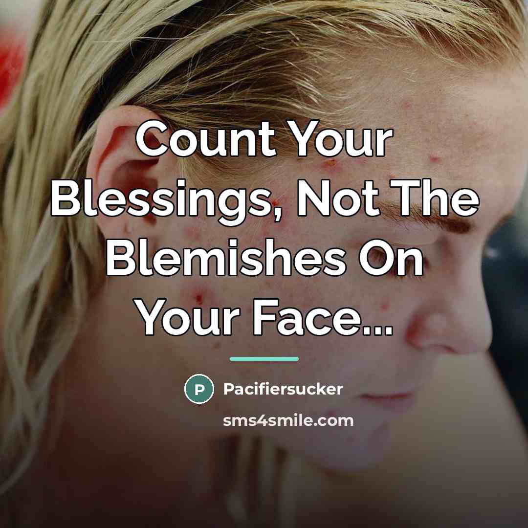 “Count Your Blessings, Not The Blemishes On Your Face...…” quote by Pacifiersucker