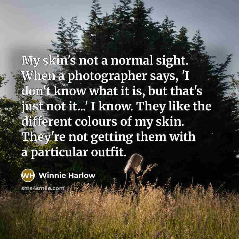 “My skin's not a normal sight. When a photographer says, 'I don't know what it is, but that's just not it...' I know. They like the different colours of my skin. They're not getting them with a particular outfit.” quote by Winnie Harlow