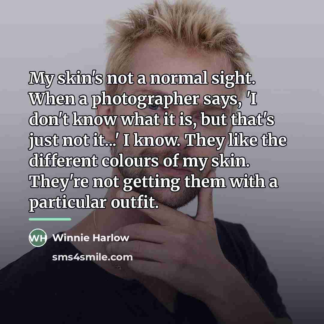 “My skin's not a normal sight. When a photographer says,…” quote by Winnie Harlow