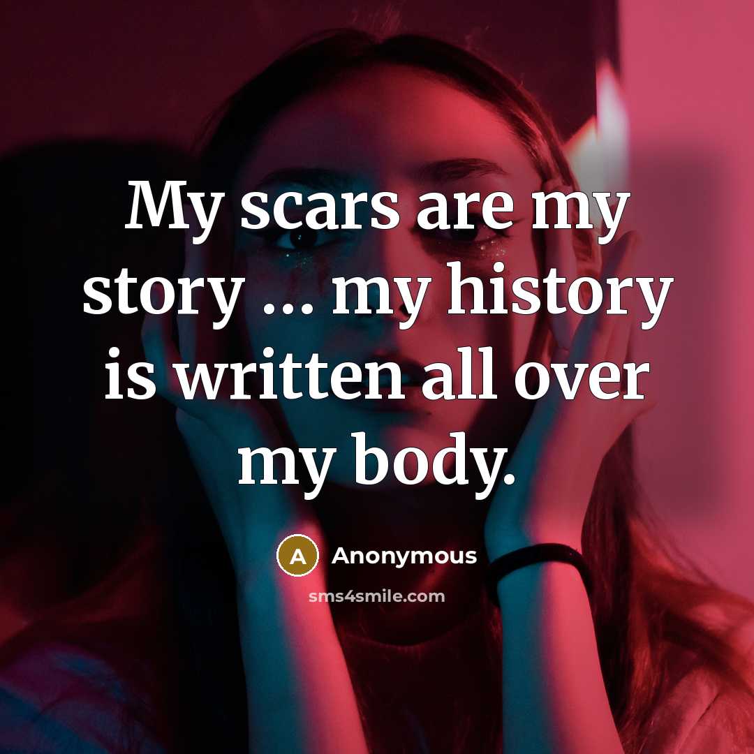 “My scars are my story .... my history is written…” quote by Anonymous