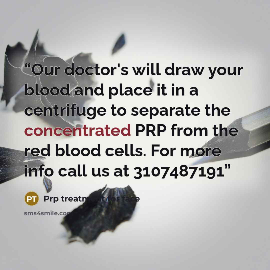 “Our doctor's will draw your blood and place it in a centrifuge to separate the concentrated PRP from the red blood cells. For more info call us at 3107487191” quote by Prp treatment for face