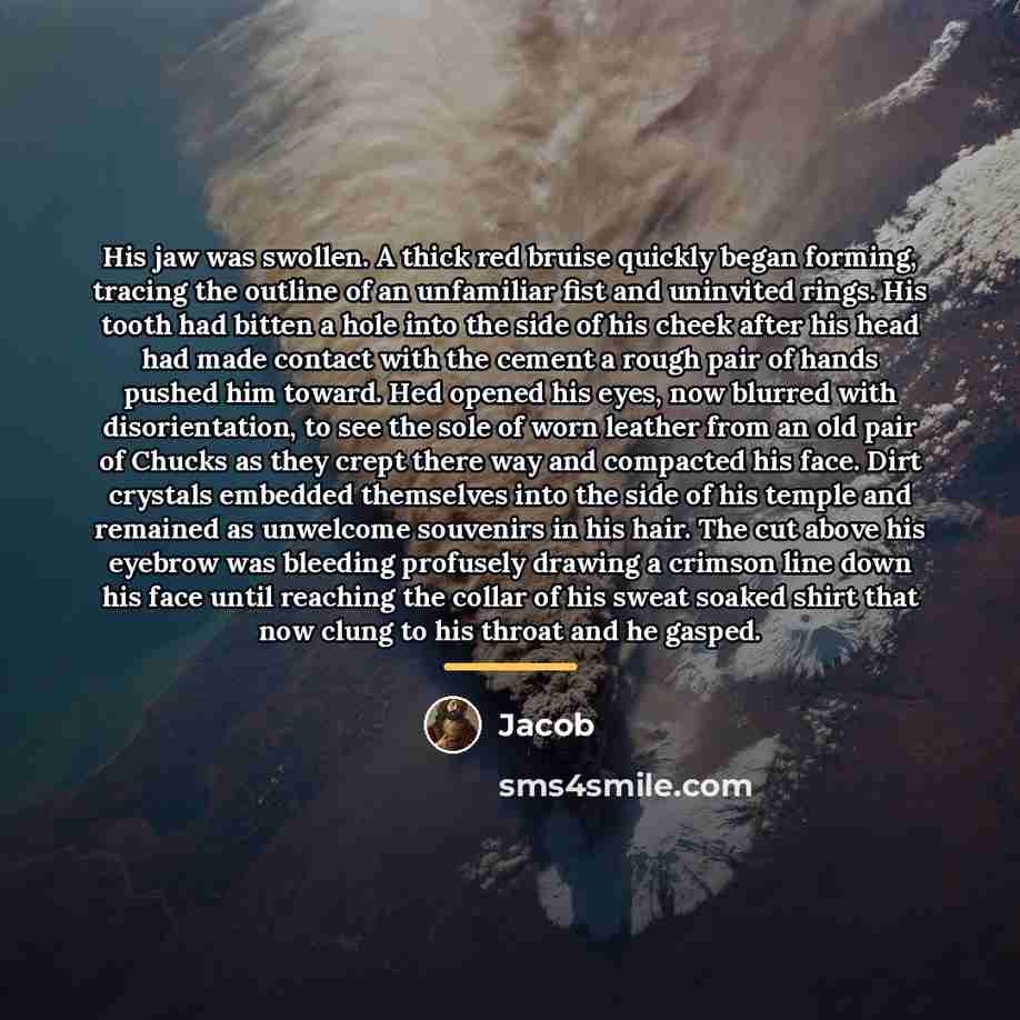 “His jaw was swollen. A thick red bruise quickly began…” quote by Jacob