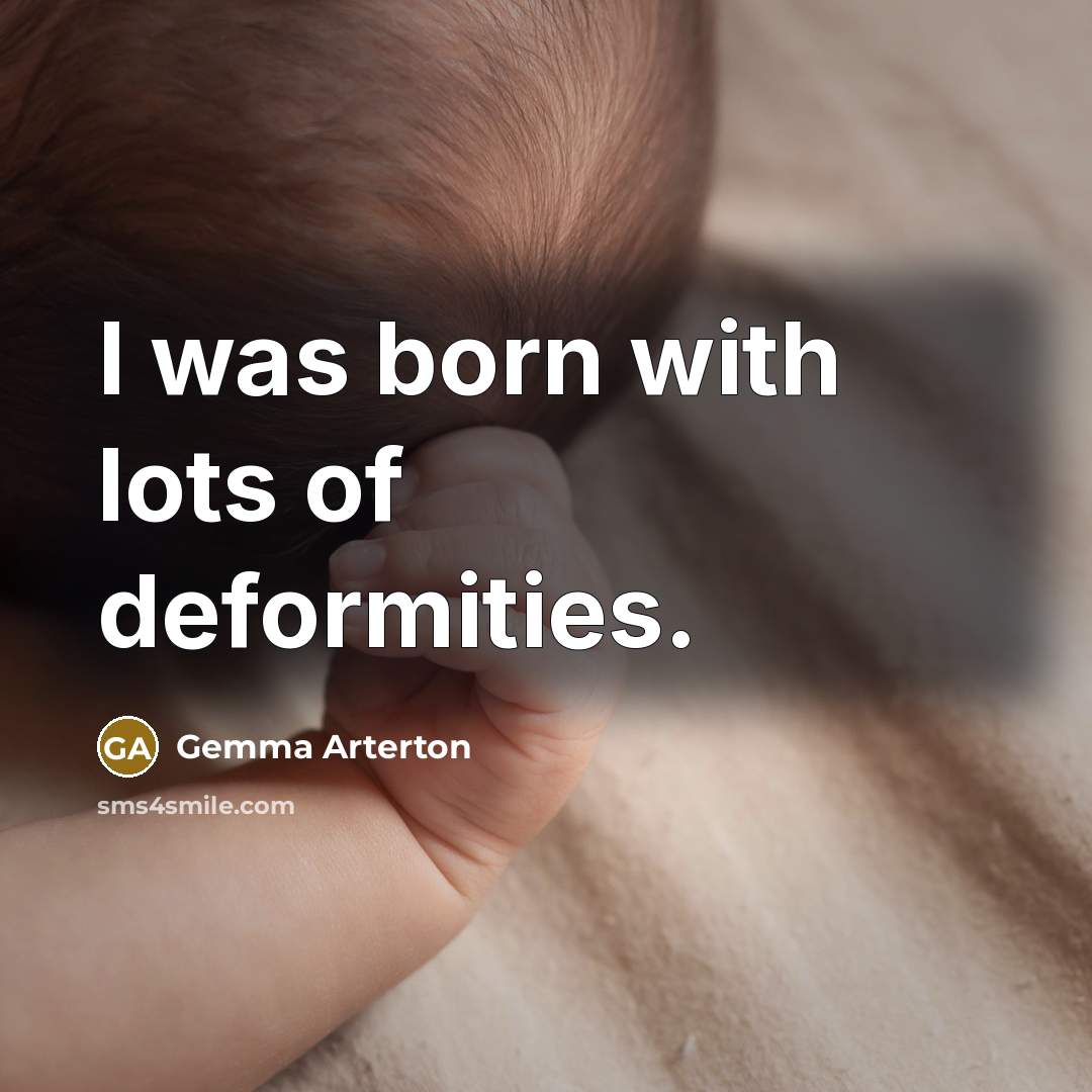 “I was born with lots of deformities.…” quote by Gemma Arterton