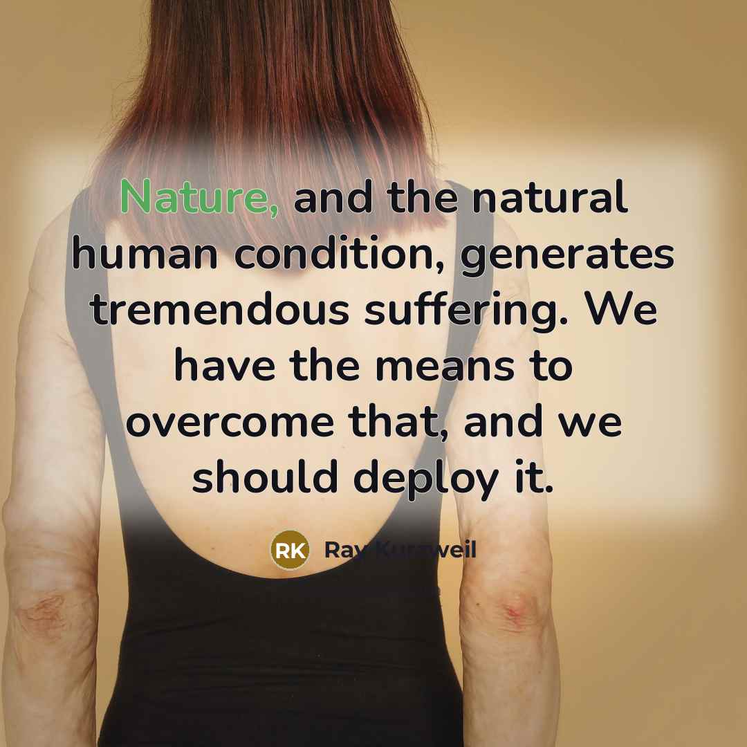 “Nature, and the natural human condition, generates tremendous suffering. We…” quote by Ray Kurzweil