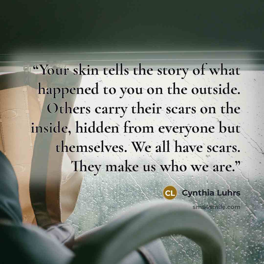 “Your skin tells the story of what happened to you on the outside. Others carry their scars on the inside, hidden from everyone but themselves. We all have scars. They make us who we are.” quote by Cynthia Luhrs