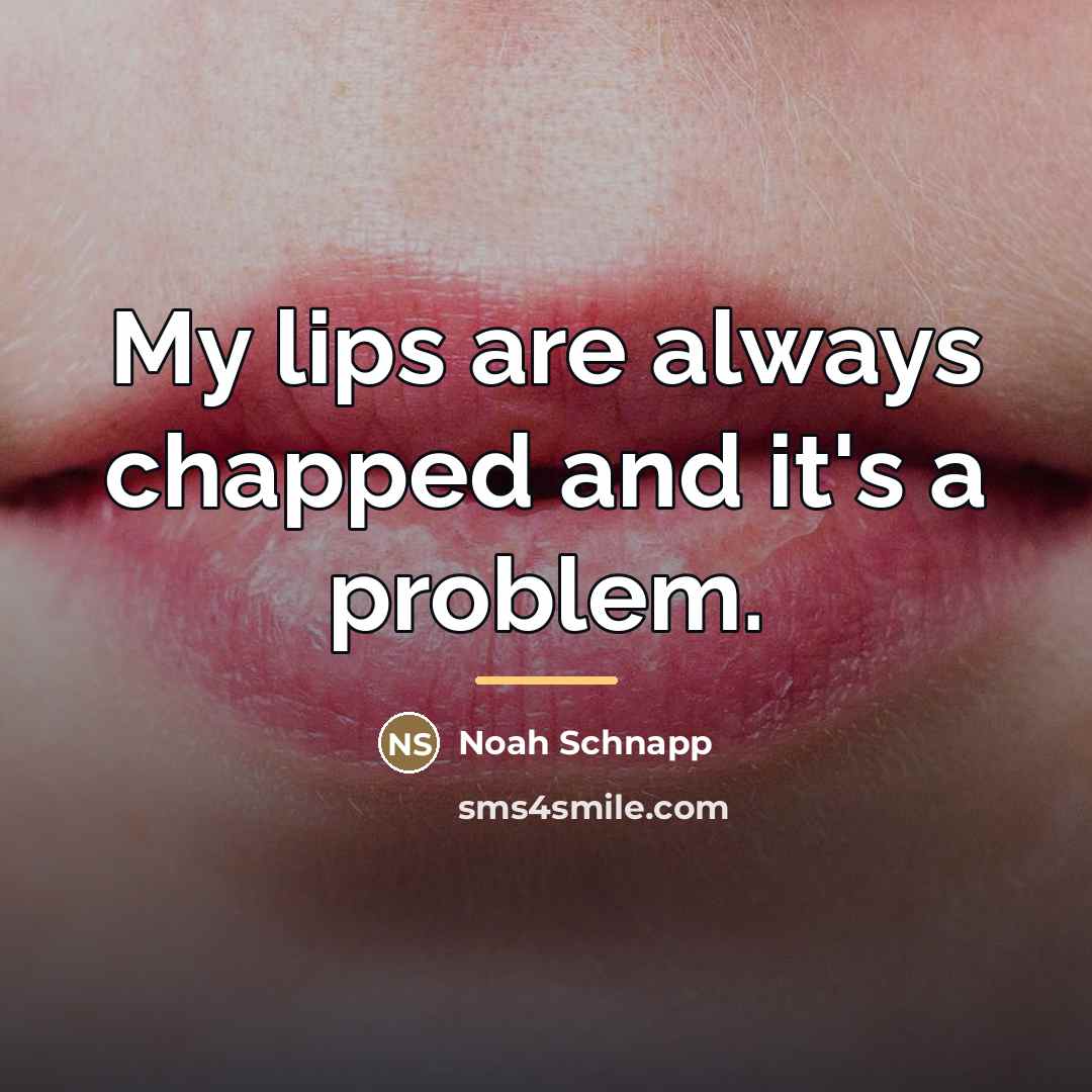 “My lips are always chapped and it's a problem.…” quote by Noah Schnapp