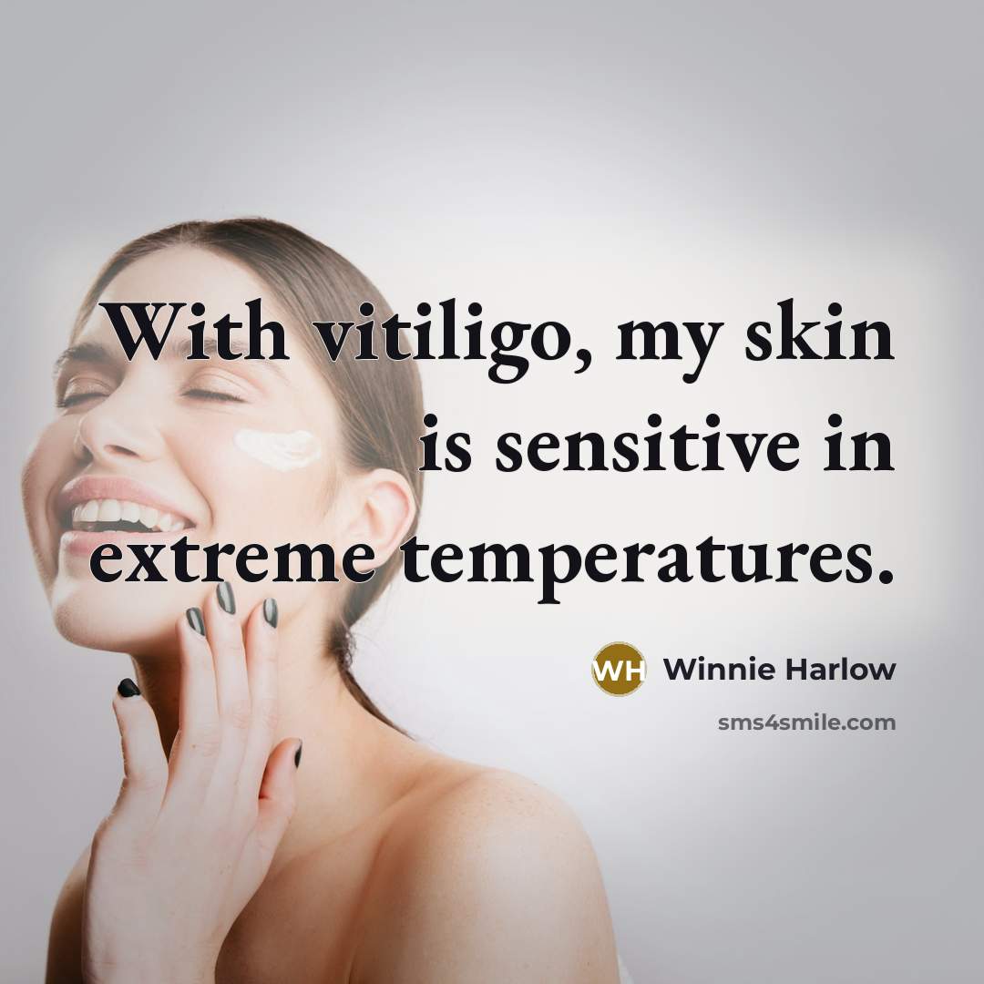 “With vitiligo, my skin is sensitive in extreme temperatures.…” quote by Winnie Harlow