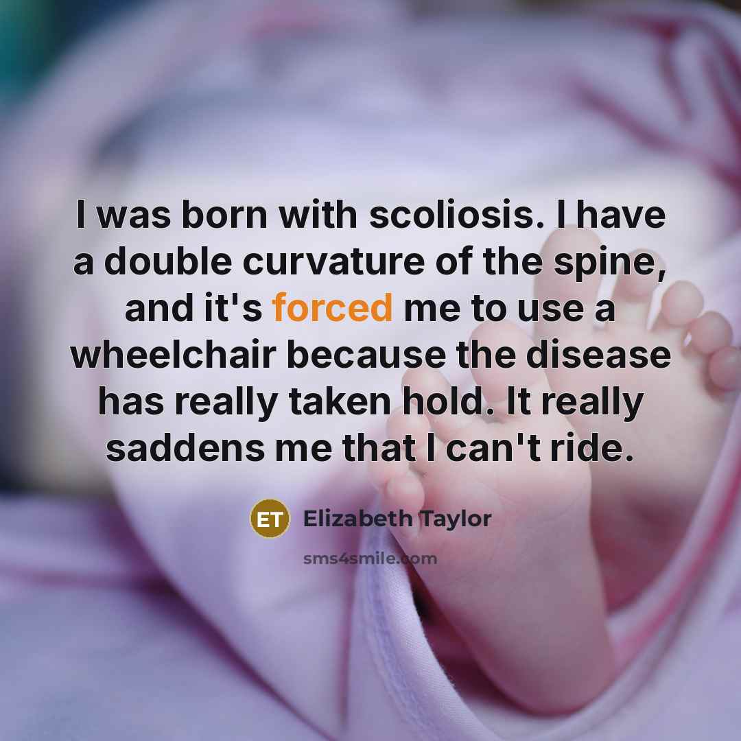 “I was born with scoliosis. I have a double curvature…” quote by Elizabeth Taylor