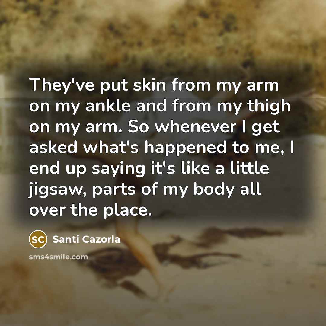 “They've put skin from my arm on my ankle and…” quote by Santi Cazorla