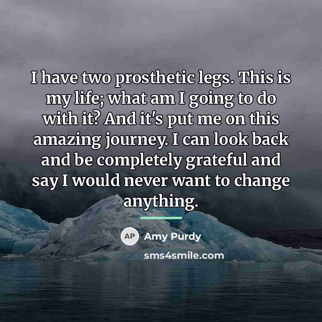 “I have two prosthetic legs. This is my life; what…” quote by Amy Purdy