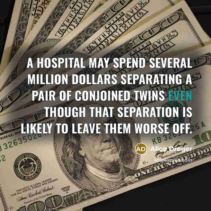“A hospital may spend several million dollars separating a pair…” quote by Alice Dreger