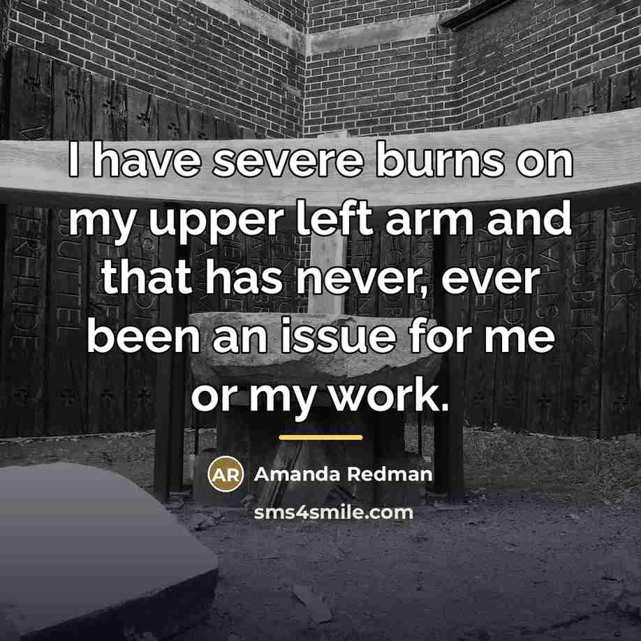 “I have severe burns on my upper left arm and…” quote by Amanda Redman