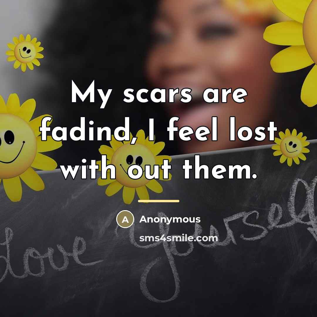 “My scars are fadind, I feel lost with out them.…” quote by Anonymous