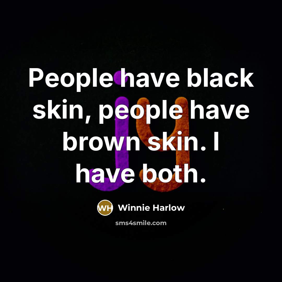 “People have black skin, people have brown skin. I have…” quote by Winnie Harlow